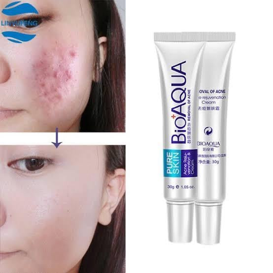 BIOAQUA Acne Removal Cream