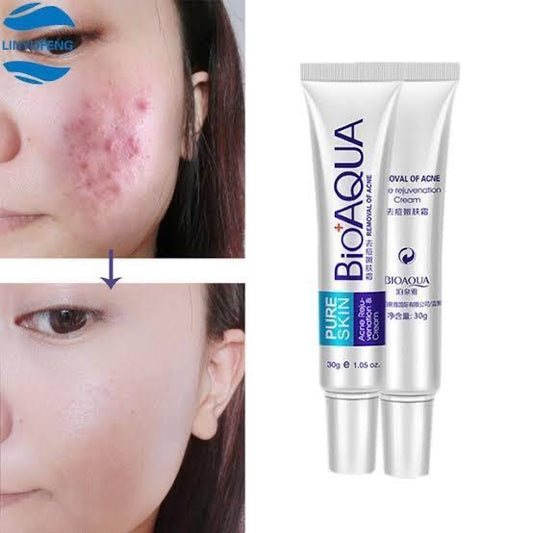 BIOAQUA Acne Removal Cream